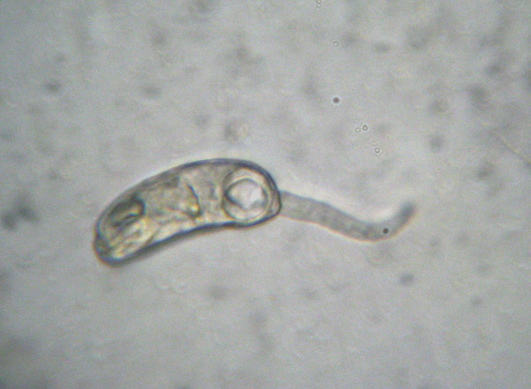 Larva di ascidiacea?